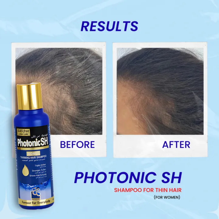 Photonic%20SH%20Shampoo%20for%20Thin%20Hair%20for%20WOMEN%20-%20Image%203