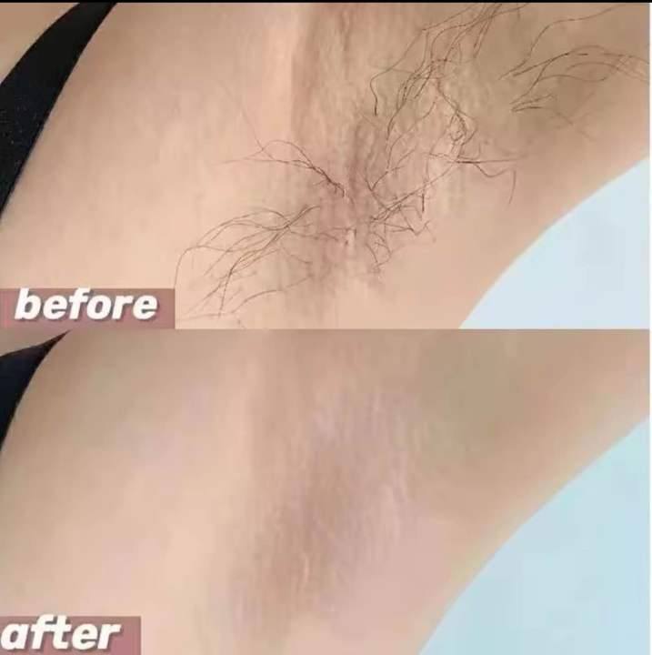 Hanpoli%20Hair%20removal%20cream%2050g%20(No%20pain,%20Smoothly)%20-%20Image%203