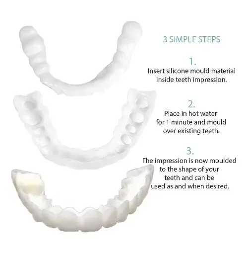 4%20pieces%20of%20white%20dentures%20-%20adjustable%20upper%20and%20lower%20dentures%20for%20men%20and%20women,%20comfortable%20fit%20and%20natural%20smile%20-%20Image%205