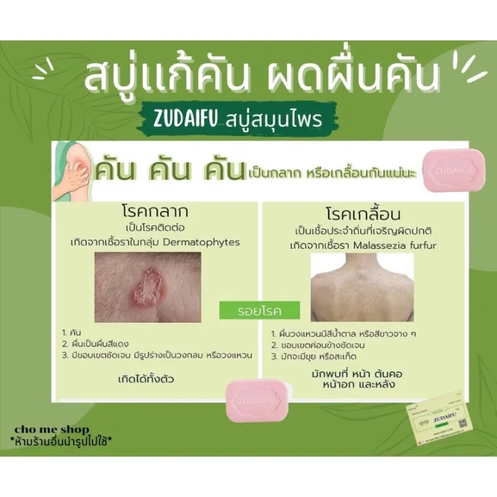 (80G/Pc)%20Zudaifu%20Sulfur%20Soap,%20100%25%20Natural%20Herbal%20Soap,%20Natural%20Whitening,%20for%20Washing%20Face,%20Washing%20Hair,%20Bathing.%20-%20Image%207