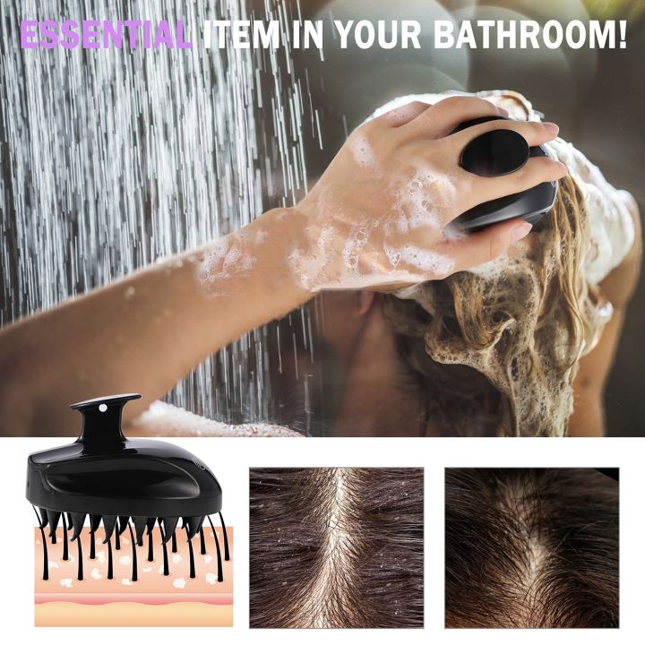 Hair%20Scalp%20Massager%20Shampoo%20Brush,%20Soft%20Silicone%20Bristles%20to%20Remove%20Dandruff,%20Waterproof%20Hair%20Scrubber%20for%20Both%20Wet%20Dry%20Hair,%20Suitable%20for%20Men%20&%20Women(Random%20Color)%20(No%20Color%20Choice)%20-%20Image%206