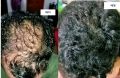 Update Organic Hair Fall Oil Treatment for strong,soft, shiny & wavy hair - 175ml.
