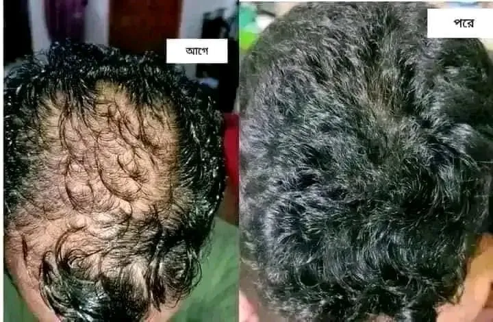 Update%20Organic%20Hair%20Fall%20Oil%20Treatment%20for%20strong,soft,%20shiny%20&%20wavy%20hair%20-%20175ml%20-%20Image%207