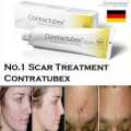 Contractubex Gel. 