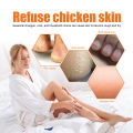 100ml Foot Peeling Spray Orange Essential Oil Exfoliating Nourish Peel Feet Calluses Dead Skin Remover Pedicure Foot Care Tool freshfeet. 