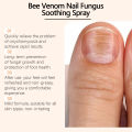 Anti Fungal Foot Spray Anti Beriberi Treatment Paronychia Onychomycosis Antibacterial Relieve Itching Feet Fungus Removal Spray freshfeet.