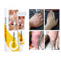 Professional Skin Care Cream Expert Skin Fighter for Psoriasis and Dermatitis for Healthy Skin 15g. 