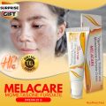 Melacare Face Cream 25 G Melacare Face Cream 25 G. 