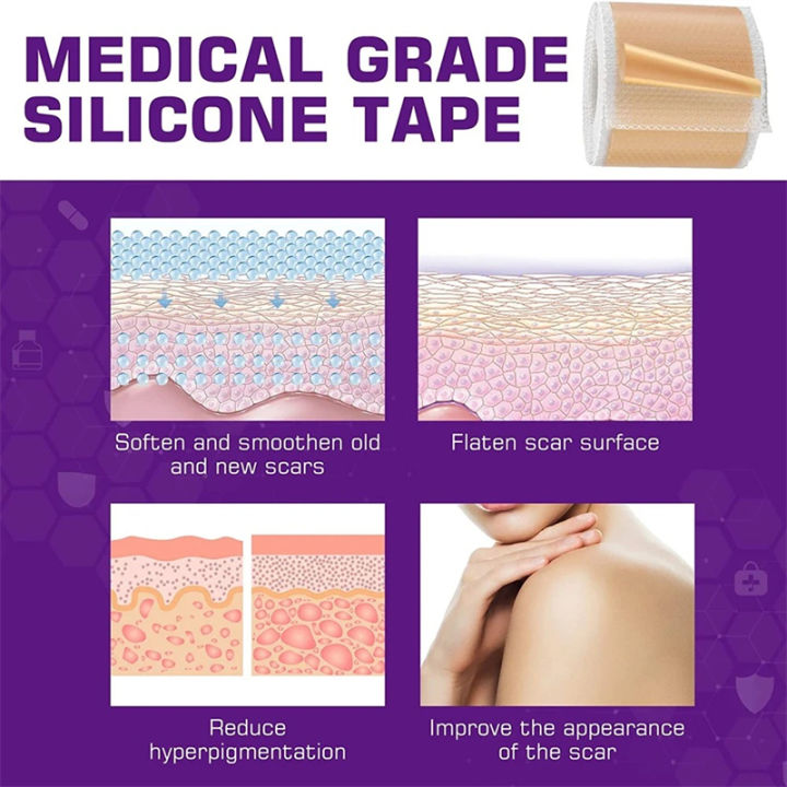 1%20Roll%20Self-Adhesive%20Scar%20Cover%20Tape%20Reusable%20and%20Effective%20Skin,Skin-Friendly%20for%20Ear%20Protection%20&%20Discreet%20Coverage%20Waterproof%20-%20Image%204