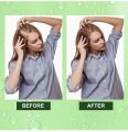 ALIVER Rosemary Essential Oil for Hair Growth, Enhanced Shine, 100% Pure Natural, Nourishment Scalp, Improves Blood Circulation, Best Serum for Skin, 2 fl oz. 