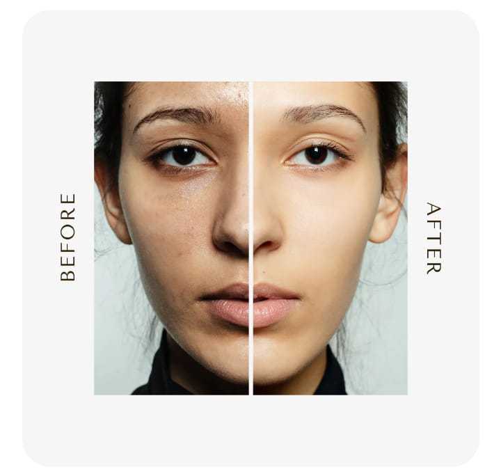 Glow%20Natural%20Glutathione%20Alpha%20Arbutin%20Skin%20Brightening%20Cream%20-%20Image%205