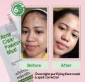 Oxecure Acne Clear Powder Mud 7g *Made in Thailand *ဝက်ခြံတို့ဆေး *ပြန်ပိတ်ထား၍ရသော အဖုံးပါ Travel pack အထုပ်ဖြစ်ပါသည် *Exp Date: 2023. 