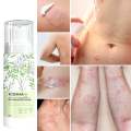 Eczemaron Anti Fungal Cream – Fast Relief from Eczema, Itching, Ringworm & Skin Infections – 50gm. 