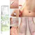 Eczemaron Anti Fungal Cream – Fast Relief from Eczema, Itching, Ringworm & Skin Infections – 50gm. 