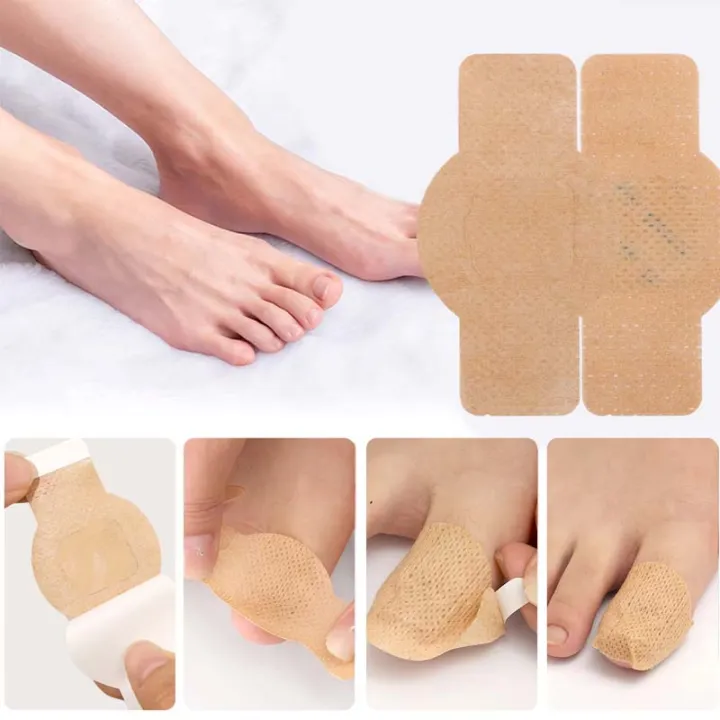 Nail%20Fungus%20Patch%20Waterproof%20Nail%20Repair%20Patch%20Ingrown%20Correction%20Sticker%20Damaged%20Nail%20Gray%20Care%20Patch%20Feet%20Care%20Tools%20-%20Image%203