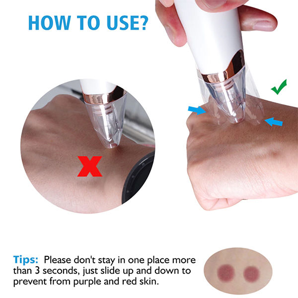 Rechargeable Device for Removing Blackheads and Whiteheads for Men and Women