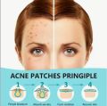Pimple patch 120pcs pimple patch high quality effective Acne patch cover. 