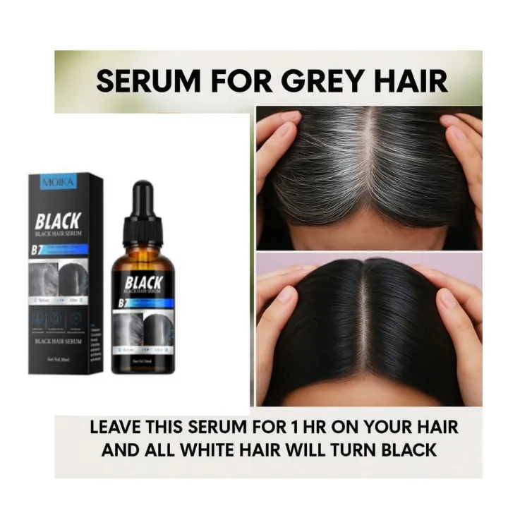 Black%20Hair%20Serum%20For%20Men%20&%20Women%20Anti%20Hair%20Fall,Hair%20Growth%2030%20Ml%20-%20Image%202