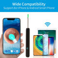 2026 Visual Ear Wax Cleaner with Camera Safe Earwax Removal Endoscope With Camera Luminous Otoscope Ear Cleaning Tools Ear Care.