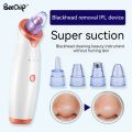 Blackhead Suction Instrument Remove Dead Skin Cells, Blackheads And Impuritie Cosmetic Face Acne Blackhead Cleanser. 