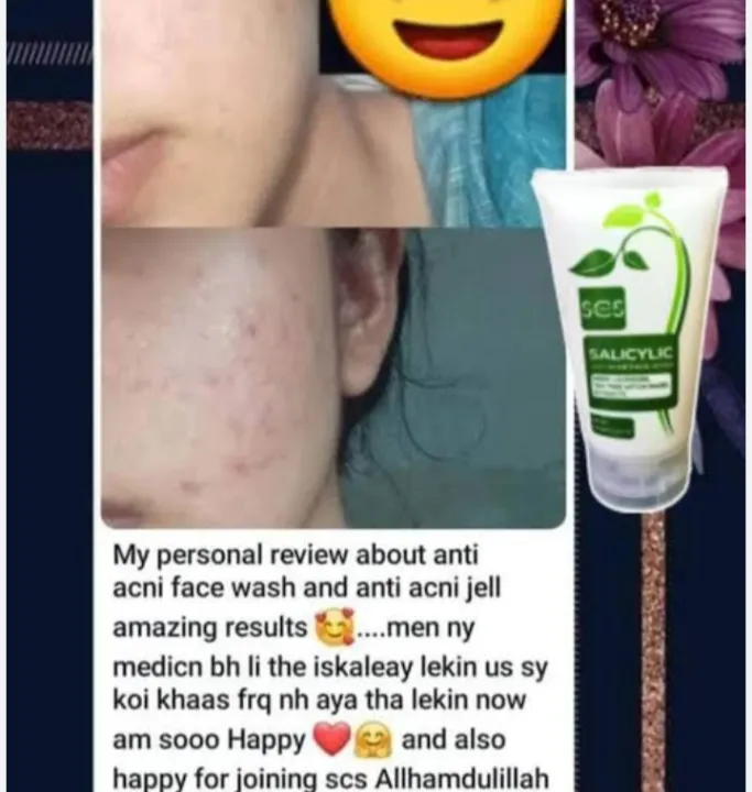 Scs%20Salicylic%20anti%20acne%20face%20wash%20for%20oily%20skin%20-%20Image%203