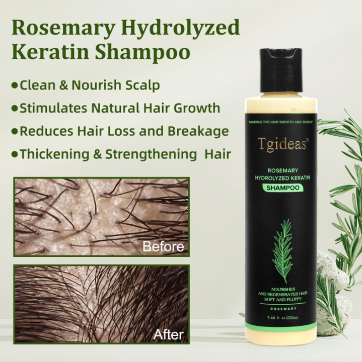 Tgideas%20Organic%20Rosemary%20Hair%20Growth%20Shampoo%20Hydrolyzed%20Keratin%20Nourish%20Scalp%20Reduce%20Loss%20Unisex%20Shampoo%20For%20Dry%20Fragile%20Hair%20-%20Image%202