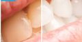 Teeth Whitening Strip with 2 PCs Cotton Swab For Cleaning Tool. 