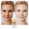 Melao Moisturizing Mist Vitamin C Whitening Arbutin Toner- & Spots Remover. 