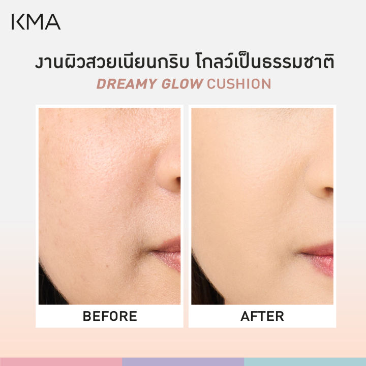 Kma%20Cushion%20Glowing%20Skin%20Spf%2050+%20Pa%20+++%20Dreamy%20Glow%20Cushion%2015g.%20-%20Image%207