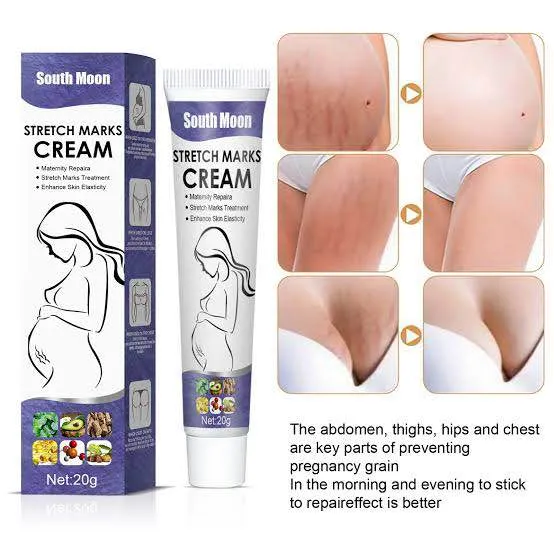 South%20Moon%20Effective%20Body%20Stretch%20Marks%20Removal%20Cream%20Lotion%20Pregnancy%20Stretch%20Mark%20Cream%20for%20Fair%20Skin%20Repair%20Cream%2020g%20-%20Image%204