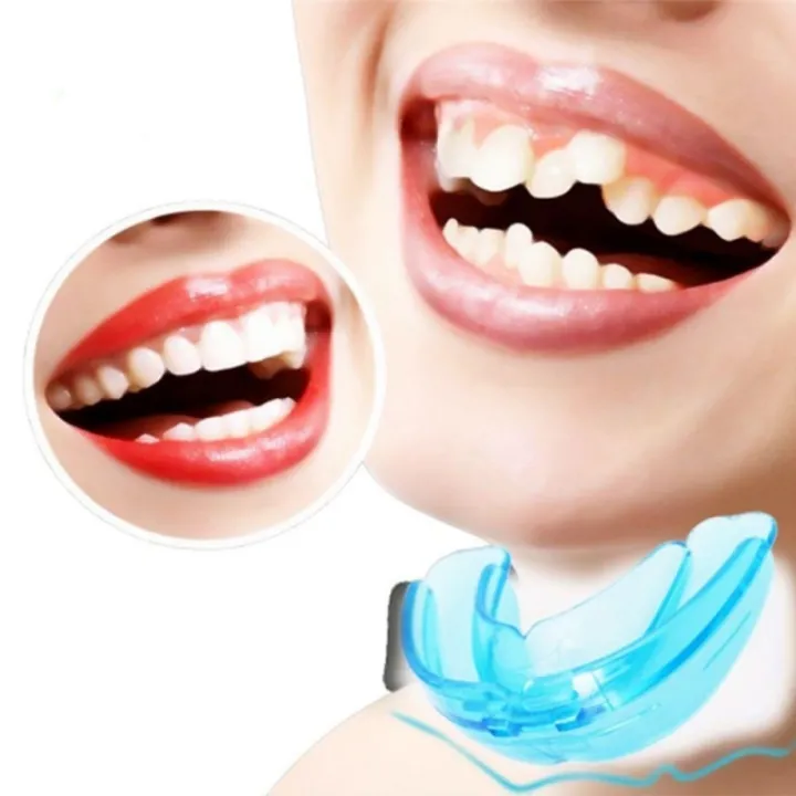 1pcs%20reusable%20plaid%20braces%20-%20plaidnature,%20used%20for%20all%20kinds%20of%20teeth,%20can%20be%20used%20during%20sports%20and%20sleep%20to%20protect%20teeth%20-%20Image%206