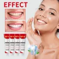 Sp 6 Ultra Whitening Sp 6 Toothpaste Ultra Whitening Toothpaste Sp - 6 Probiotic Brightening ToothpasteDeep Cleaning Care Toothp. 