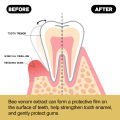 Gum Repair Toothpaste Plaque Caries Removal Protect Gingiva Treat Bad Breath Fade Tooth Stain Deep Clean Brightening Toothpaste. 