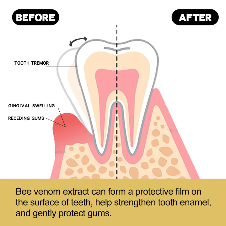 Gum%20Repair%20Toothpaste%20Plaque%20Caries%20Removal%20Protect%20Gingiva%20Treat%20Bad%20Breath%20Fade%20Tooth%20Stain%20Deep%20Clean%20Brightening%20Toothpaste%20-%20Image%204