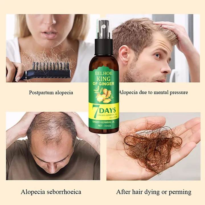 7%20Day%20Ginger%20Hair%20Growth%20Essence%20Germinal%20Serum%20Essence%20Oil%20Natural%20Hair%20Loss%20Treatement%20Effective%20Fast%20Growth%20Hair%20Care%20-50ML%20-%20Image%202
