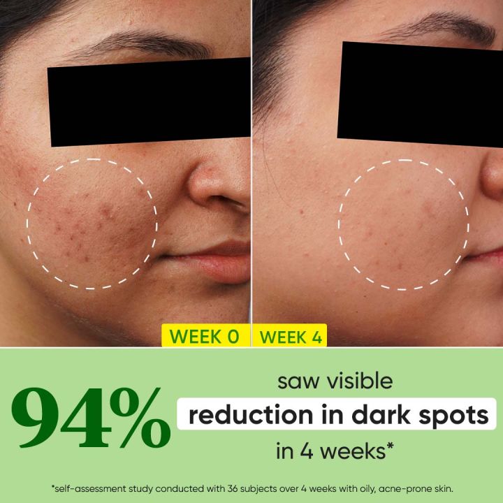 Dot%20&%20Key%20Cica%20+%2010%25%20Niacinamide%20Face%20Serum%20for%20Oily%20Skin%2030ml%20-%20Image%203