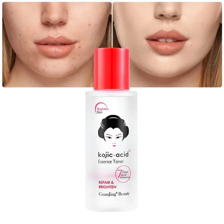 Kojic%20Acid%20Repair%20&%20Brighten%20Essence%20Toner%20-%20100ml%20-%20Image%203