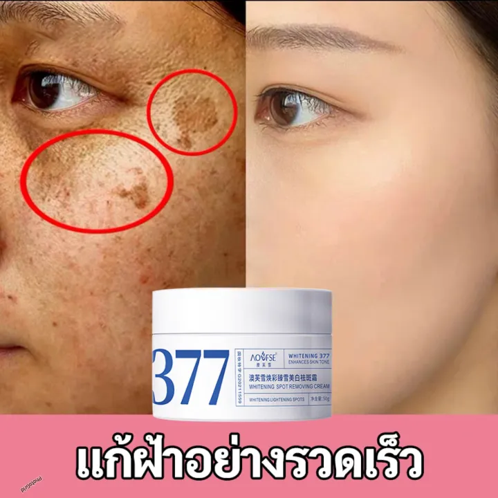 377%20Whitening%20Spot%20Removal%20Cream%2050%20GM%20-%20Image%207