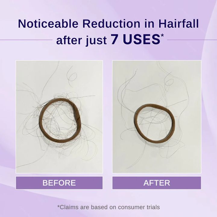 BARE%20ANATOMY%20Rosemary%20&%20Hibiscus%20Hair%20Growth%20Oil%20enriched%20with%20Bhringraj%20for%20New%20Hair%20Growth%20Hair%20Oil%20(100%20ml)%20-%20Image%203