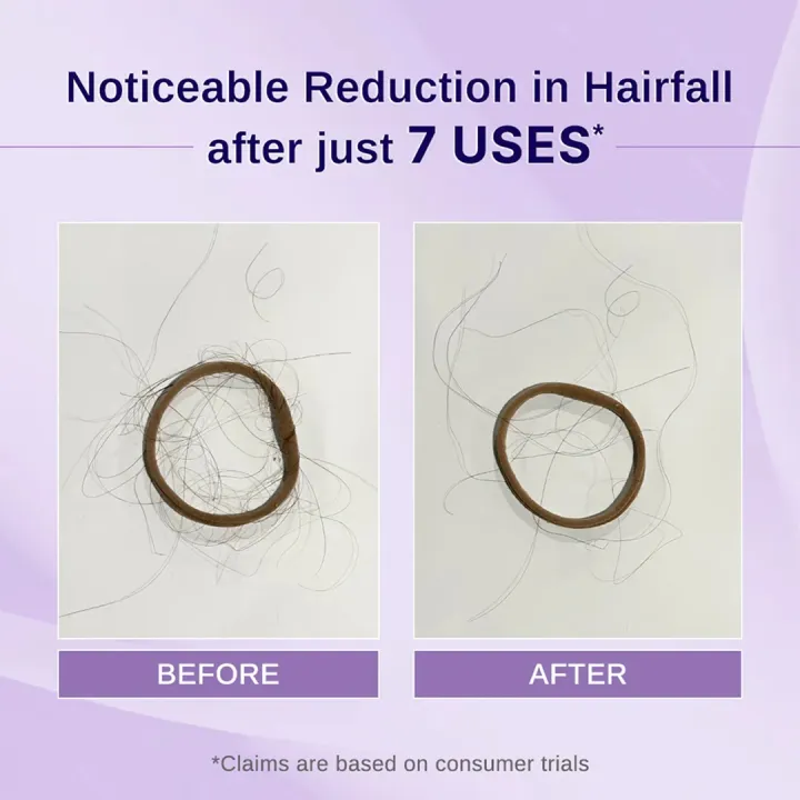 BARE%20ANATOMY%20Rosemary%20&%20Hibiscus%20Hair%20Growth%20Oil%20enriched%20with%20Bhringraj%20for%20New%20Hair%20Growth%20Hair%20Oil%20(100%20ml)%20-%20Image%203