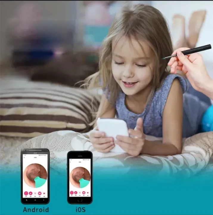 Smart%20Visual%20Ear%20Cleaner%20with%20Hd%20Camera%20Led%20Light%20Wireless%20Ear%20Wax%20Removal%20Tool%20Limited%20Stock%20Offer%20-%20Image%206