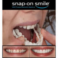 Pack Of 2 Pairs Snap-On Smile Custom Fit Perfect Smile Veneers In 3 Easy Steps. 
