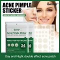 24/36pcs Hydrocolloid Acne Patch Blemish Stickers For Face And Skin Breathable Waterproof Gentle Non-Irritating Acne Stickers. 