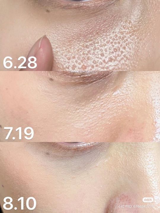 MOOSUN%20Centella%20Ticatiny%20Acid%20Bubbles%20Mask%20100g%20-%20Image%209