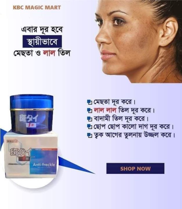 Anti%20Freckle%20Cream%2025gm%20-%20Image%202
