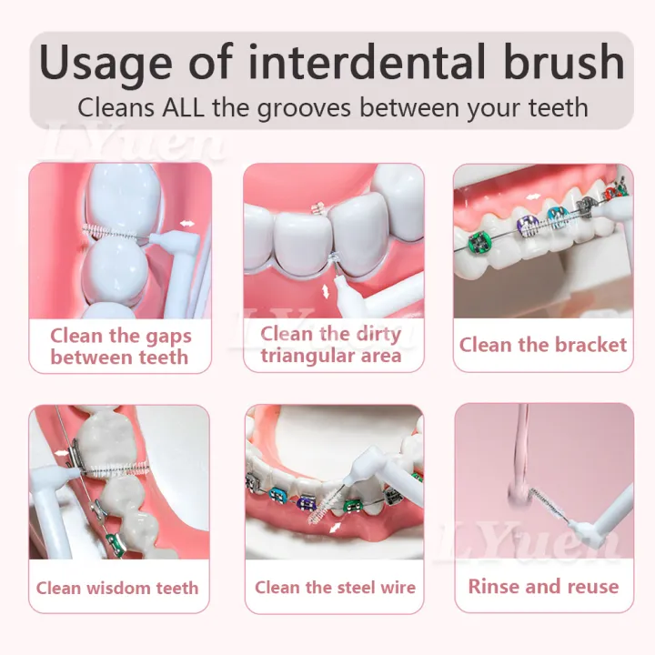 20Pcs/box%20L%20Shape%20Push-Pull%20Interdental%20Brush%20Orthodontic%20Toothpick%20Teeth%20%20Tooth%20Pick%20ToothBrush%20Oral%20Hygiene%20Care%20-%20Image%203