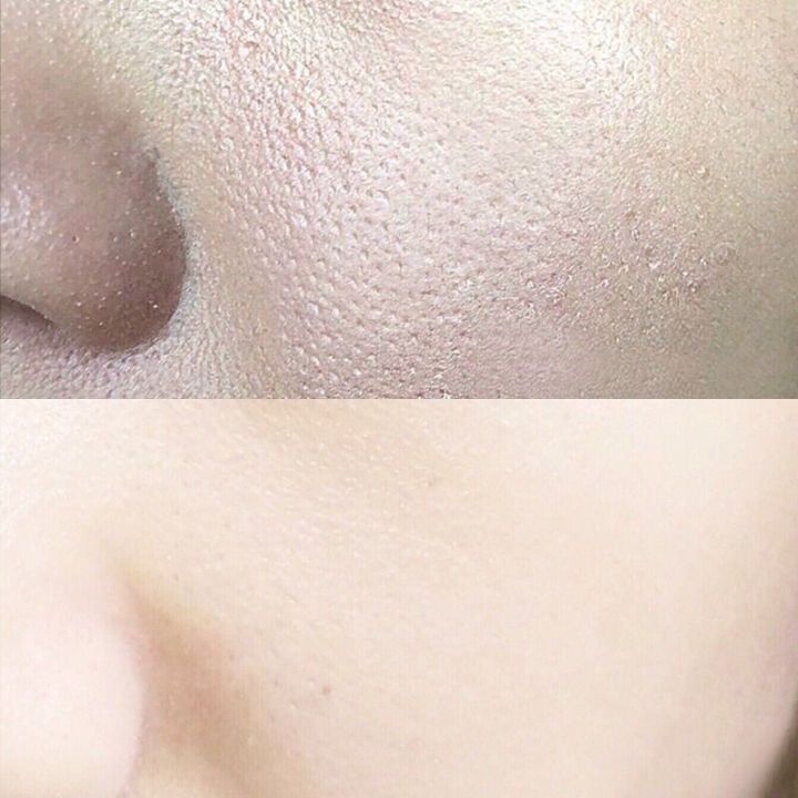 701%20Collagen%20Soap%2085g%20-%20Image%205