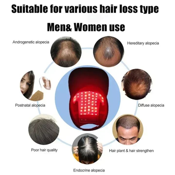 LED%20Red%20Light%20Therapy%20Cap%20Hair%20Growth%20Helmet%20Diode%20LaserHat%20Light%20Therapy%20Cap%20for%20Hair%20Regrowth%20and%20Hair%20Loss%20Treatment%20-%20Image%205