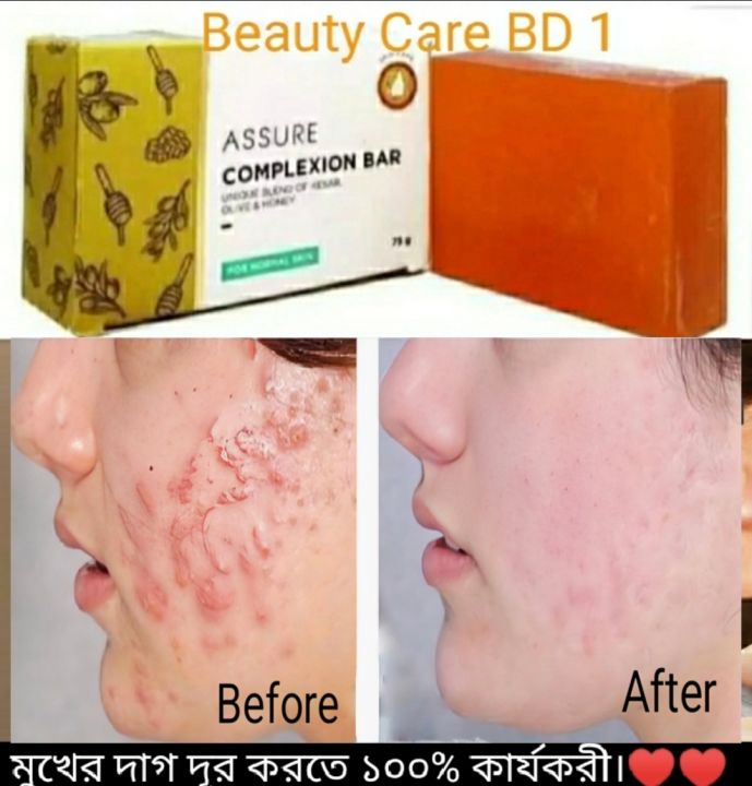 Assure%20Complexion%20bar%20Soap%2075g%20Indian%20Honey%20is%20enriched%20with%20olives%20and%20saffron%20-%20Image%209