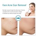 Acne Wrinkle Removal Laser Pen Skin Spots Removal Anti Varicose Spider Vein Treatment Medical Blue Light Eye Treatment Instrumen. 